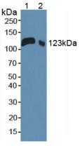 CD118 / LIF Receptor Alpha Antibody - Western Blot; Sample: Lane1: Mouse Serum; Lane2: Mouse Placenta Tissue.