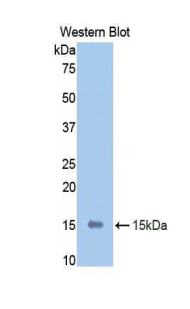 CD118 / LIF Receptor Alpha Antibody - Western blot of recombinant CD118 / LIFR.  This image was taken for the unconjugated form of this product. Other forms have not been tested.