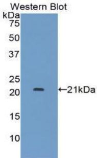 CD118 / LIF Receptor Alpha Antibody - Western blot of recombinant CD118 / LIFR.  This image was taken for the unconjugated form of this product. Other forms have not been tested.