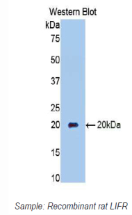 CD118 / LIF Receptor Alpha Antibody - Western blot of recombinant CD118 / LIFR.  This image was taken for the unconjugated form of this product. Other forms have not been tested.