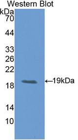 CD118 / LIF Receptor Alpha Antibody - Western Blot; Sample: Recombinant protein.