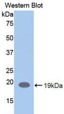 CD118 / LIF Receptor Alpha Antibody - Western Blot; Sample: Recombinant protein.