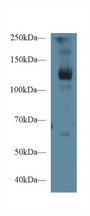 CD118 / LIF Receptor Alpha Antibody - Western Blot; Sample: Porcine Skeletal muscle lysate; ;Primary Ab: 1µg/ml Rabbit Anti-Human LIFR Antibody;Second Ab: 0.2µg/mL HRP-Linked Caprine Anti-Rabbit IgG Polyclonal Antibody;