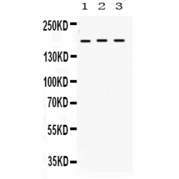 CD118 / LIF Receptor Alpha Antibody - LIFR antibody Western blot. All lanes: Anti LIFR at 0.5 ug/ml. Lane 1: SW620 Whole Cell Lysate at 40 ug. Lane 2: COLO320 Whole Cell Lysate at 40 ug. Lane 3: HEPG2 Whole Cell Lysate at 40 ug. Predicted band size: 190 kD. Observed band size: 190 kD.