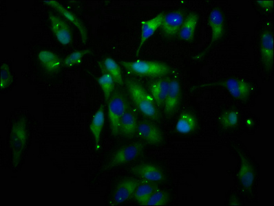 CD118 / LIF Receptor Alpha Antibody - Immunofluorescence staining of Hela cells at a dilution of 1:200, counter-stained with DAPI. The cells were fixed in 4% formaldehyde, permeabilized using 0.2% Triton X-100 and blocked in 10% normal Goat Serum. The cells were then incubated with the antibody overnight at 4°C.The secondary antibody was Alexa Fluor 488-congugated AffiniPure Goat Anti-Rabbit IgG (H+L) .