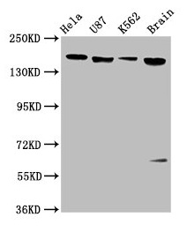 CD118 / LIF Receptor Alpha Antibody - Western Blot Positive WB detected in: Hela whole cell lysate, U87 whole cell lysate, K562 whole cell lysate, Rat brain tissue All lanes: LIFR antibody at 3.4µg/ml Secondary Goat polyclonal to rabbit IgG at 1/50000 dilution Predicted band size: 124 kDa Observed band size: 190 kDa