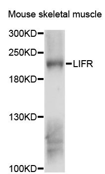 CD118 / LIF Receptor Alpha Antibody - Western blot analysis of extracts of mouse skeletal muscle, using LIFR antibody at 1:3000 dilution. The secondary antibody used was an HRP Goat Anti-Rabbit IgG (H+L) at 1:10000 dilution. Lysates were loaded 25ug per lane and 3% nonfat dry milk in TBST was used for blocking. An ECL Kit was used for detection and the exposure time was 30s.