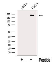 CD118 / LIF Receptor Alpha Antibody - Western blot analysis of extracts of HeLa cells using LIFR antibody. The lane on the left was treated with blocking peptide.