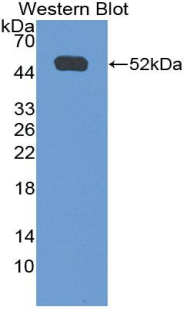 CD119 / IFNGR1 Antibody - Western blot of recombinant CD119 / IFNGR1.  This image was taken for the unconjugated form of this product. Other forms have not been tested.