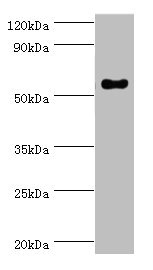 CD119 / IFNGR1 Antibody - Western blot All lanes: IFNGR1 antibody at 2µg/ml + Mouse lung tissue Secondary Goat polyclonal to rabbit IgG at 1/10000 dilution Predicted band size: 55, 22 kDa Observed band size: 55 kDa