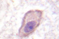 CD119 / IFNGR1 Antibody - IHC of IFN-R (G456) pAb in paraffin-embedded human brain tissue.