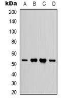 CD119 / IFNGR1 Antibody - Western blot analysis of IFNGR1 expression in HEK293T (A); HeLa (B); rat heart (C); rat brain (D) whole cell lysates.