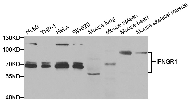 CD119 / IFNGR1 Antibody - Western blot analysis of extracts of various cell lines, using IFNGR1 antibody.