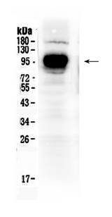 CD119 / IFNGR1 Antibody - Western blot - Anti-IFNGR1/Cd119 Picoband Antibody