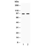 CD119 / IFNGR1 Antibody - Western blot testing of human 1) HepG2 and 2) SKOV3 cell lysate with IFNGR1 antibody at 0.5ug/ml. Predicted molecular weight: ~54 kDa (unmodified), 80-100 kDa (glycosylated).