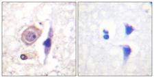 CD119 / IFNGR1 Antibody - Peptide - + Immunohistochemistry analysis of paraffin-embedded human brain tissue using Interferon-? Receptor a chain (Ab-457) antibody.