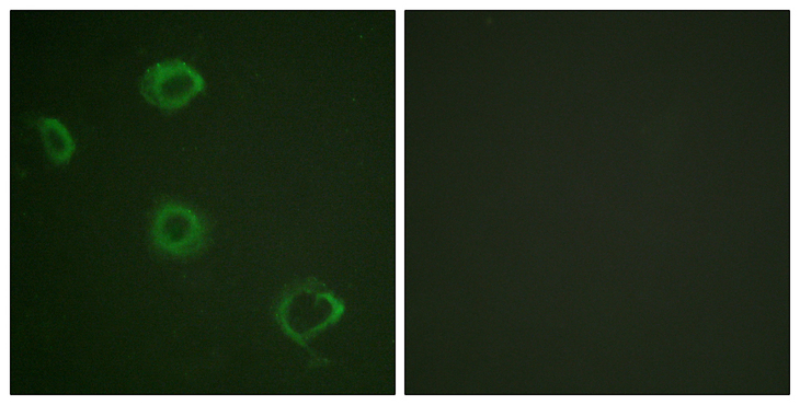 CD119 / IFNGR1 Antibody - Immunofluorescence analysis of A549 cells, using Interferon-gamma Receptor alpha (Phospho-Tyr457) Antibody. The picture on the right is blocked with the phospho peptide.