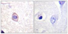 CD119 / IFNGR1 Antibody - Immunohistochemistry analysis of paraffin-embedded human brain, using Interferon-gamma Receptor alpha (Phospho-Tyr457) Antibody. The picture on the right is blocked with the phospho peptide.