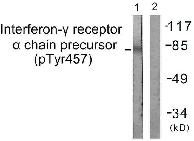 CD119 / IFNGR1 Antibody - Western blot analysis of lysates from COS7 cells, using Interferon-gamma Receptor alpha (Phospho-Tyr457) Antibody. The lane on the right is blocked with the phospho peptide.