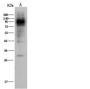 CD119 / IFNGR1 Antibody - Anti-IFNgR1 rabbit polyclonal antibody at 1:500 dilution. Lane A: HepG2 Whole Cell Lysate. Lysates/proteins at 30 ug per lane. Secondary: Goat Anti-Rabbit IgG (H+L)/HRP at 1/10000 dilution. Developed using the ECL technique. Performed under reducing conditions. Predicted band size: 54 kDa. Observed band size: 100 kDa.