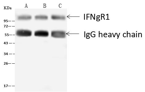 CD119 / IFNGR1 Antibody - IFNgR1 was immunoprecipitated using: Lane A: 0.5 mg HeLa Whole Cell Lysate. Lane B: 0.5 mg 293T Whole Cell Lysate. Lane C:0.5 mg HepG2 Whole Cell Lysate. 4 uL anti-IFNgR1 rabbit polyclonal antibody and 60 ug of Immunomagnetic beads Protein A/G. Primary antibody: Anti-IFNgR1 rabbit polyclonal antibody, at 1:100 dilution. Secondary antibody: Goat Anti-Rabbit IgG (H+L)/HRP at 1/10000 dilution. Developed using the ECL technique. Performed under reducing conditions. Predicted band size: 54 kDa. Observed band size: 100 kDa.