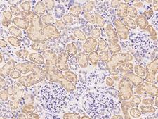 CD119 / IFNGR1 Antibody - Immunochemical staining of human IFNgR1 in human kidney with rabbit polyclonal antibody at 1:1000 dilution, formalin-fixed paraffin embedded sections.