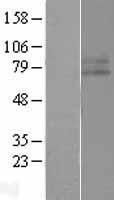 CD119 / IFNGR1 Protein - Western validation with an anti-DDK antibody * L: Control HEK293 lysate R: Over-expression lysate