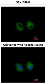 CD121b / IL1R2 Antibody - Immunofluorescence of methanol-fixed A549 using IL1 Receptor 2 antibody at 1:500 dilution.