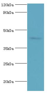 CD121b / IL1R2 Antibody - Western blot. All lanes: Interleukin-1 receptor type 2 antibody at 3 ug/ml+mouse kidney tissue. Secondary antibody: Goat polyclonal to rabbit at 1:10000 dilution. Predicted band size: 45 kDa. Observed band size: 45 kDa.