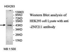 CD121b / IL1R2 Antibody