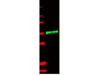 CD121b / IL1R2 Antibody - Anti-IL-1RII Antibody - Western Blot. Western blot of anti-IL-1RII antibody. This blot shows detection of an IL-1RII-GST fusion protein (~500 ng, lane 1, green, 800 nm channel). Minimal reactivity is observed against GST (data not shown). Protein was resolved on a 4-20% Tris-Glycine gel by SDS-PAGE and transferred onto nitrocellulose. After blocking, the membrane was probed with the primary antibody diluted to 1:1000. Incubation was for 2 hrs at room temperature followed by washes and reaction with a 1:10000 dilution of IRDye 800 conjugated Gt-a-Rabbit IgG (H&L) MX10 ( for 45 min at room temperature. Molecular weight markers are shown for size comparison (lane M, red, 700 nm channel). IRDye 800 fluorescence image was captured using the Odyssey Infrared Imaging System developed by LI-COR. IRDye is a trademark of LI-COR, Inc. Other detection systems will yield similar results.