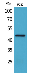 CD121b / IL1R2 Antibody - Western Blot analysis of extracts from PC12 cells using IL1R2 Antibody.