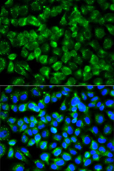 CD121b / IL1R2 Antibody - Immunofluorescence analysis of A-549 cells using IL1R2 antibody. Blue: DAPI for nuclear staining.