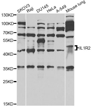 CD121b / IL1R2 Antibody - Western blot analysis of extracts of various cell lines, using IL1R2 antibody at 1:1000 dilution. The secondary antibody used was an HRP Goat Anti-Rabbit IgG (H+L) at 1:10000 dilution. Lysates were loaded 25ug per lane and 3% nonfat dry milk in TBST was used for blocking. An ECL Kit was used for detection and the exposure time was 60s.