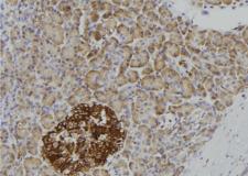 CD121b / IL1R2 Antibody - 1:100 staining human pancreas tissue by IHC-P. The sample was formaldehyde fixed and a heat mediated antigen retrieval step in citrate buffer was performed. The sample was then blocked and incubated with the antibody for 1.5 hours at 22°C. An HRP conjugated goat anti-rabbit antibody was used as the secondary.