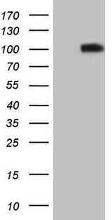 CD135 / FLT3 Antibody - HEK293T cells were transfected with the pCMV6-ENTRY control. (Left lane) or pCMV6-ENTRY FLT3. (Right lane) cDNA for 48 hrs and lysed. Equivalent amounts of cell lysates. (5 ug per lane) were separated by SDS-PAGE and immunoblotted with anti-FLT3. (1:500)