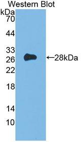 CD135 / FLT3 Antibody - Western blot of CD135 / FLT3 antibody.