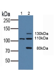 CD135 / FLT3 Antibody - Western Blot; Sample: Lane1: Human K562 Cells; Lane2: Human HepG2 Cells.