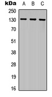 CD135 / FLT3 Antibody - Western blot analysis of CD135 expression in HeLa (A); HEK293T (B); MCF7 (C) whole cell lysates.