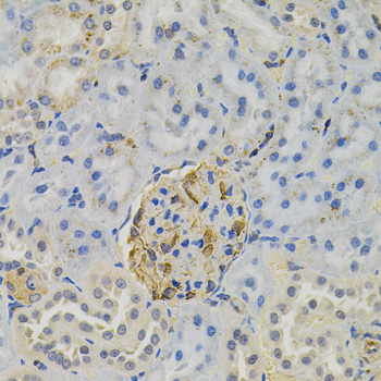 CD135 / FLT3 Antibody - Immunohistochemistry of paraffin-embedded rat kidney tissue.