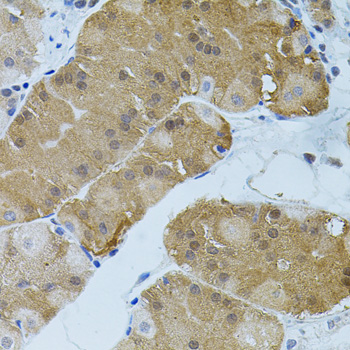 CD135 / FLT3 Antibody - Immunohistochemistry of paraffin-embedded human stomach tissue.