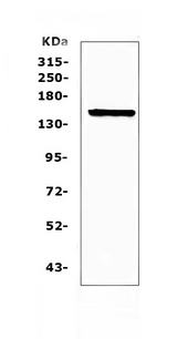 CD135 / FLT3 Antibody - Western blot analysis of Flt3 / CD135 using anti-Flt3 / CD135 antibody. Electrophoresis was performed on a 5-20% SDS-PAGE gel at 70V (Stacking gel) / 90V (Resolving gel) for 2-3 hours. The sample well of each lane was loaded with 50ug of sample under reducing conditions. Lane 1: mouse brain tissue lysates. After Electrophoresis, proteins were transferred to a Nitrocellulose membrane at 150mA for 50-90 minutes. Blocked the membrane with 5% Non-fat Milk/ TBS for 1.5 hour at RT. The membrane was incubated with rabbit anti-Flt3 / CD135 antigen affinity purified polyclonal antibody at 0.5 ug/mL overnight at 4?, then washed with TBS-0.1% Tween 3 times with 5 minutes each and probed with a goat anti-rabbit IgG-HRP secondary antibody at a dilution of 1:10000 for 1.5 hour at RT. The signal is developed using an Enhanced Chemiluminescent detection (ECL) kit with Tanon 5200 system. A specific band was detected for Flt3 / CD135 at approximately 160KD. The expected band size for Flt3 / CD135 is at 113KD.