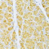 CD135 / FLT3 Antibody - Immunohistochemistry of paraffin-embedded rat pancreas using FLT3 antibody at dilution of 1:100 (40x lens).