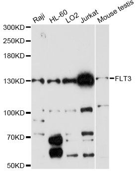 CD135 / FLT3 Antibody - Western blot analysis of extracts of various cell lines, using FLT3 antibody at 1:1000 dilution. The secondary antibody used was an HRP Goat Anti-Rabbit IgG (H+L) at 1:10000 dilution. Lysates were loaded 25ug per lane and 3% nonfat dry milk in TBST was used for blocking. An ECL Kit was used for detection and the exposure time was 60s.