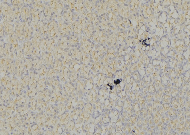CD135 / FLT3 Antibody - 1:100 staining mouse liver tissue by IHC-P. The sample was formaldehyde fixed and a heat mediated antigen retrieval step in citrate buffer was performed. The sample was then blocked and incubated with the antibody for 1.5 hours at 22°C. An HRP conjugated goat anti-rabbit antibody was used as the secondary.