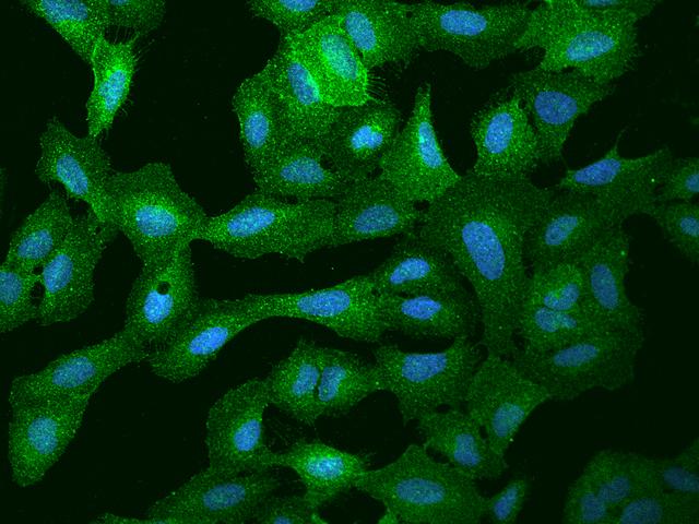 CD135 / FLT3 Antibody - Immunofluorescence staining of FLT3 in U2OS cells. Cells were fixed with 4% PFA, permeabilzed with 0.1% Triton X-100 in PBS, blocked with 10% serum, and incubated with rabbit anti- FLT3 polyclonal antibody (dilution ratio 1:200) at 4°C overnight. Then cells were stained with the Alexa Fluor 488-conjugated Goat Anti-rabbit IgG secondary antibody (green) and counterstained with DAPI (blue). Positive staining was localized to Cytoplasm and cell membrane.