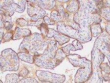 CD135 / FLT3 Antibody - Immunohistochemistry of paraffin-embedded Human placenta using FLT3 Polycloanl Antibody at dilution of 1:200