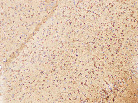 CD135 / FLT3 Antibody - Immunohistochemistry of paraffin-embedded Mouse brain using FLT3 Polycloanl Antibody at dilution of 1:200
