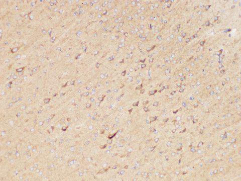 CD135 / FLT3 Antibody - Immunohistochemistry of paraffin-embedded Rat brain using FLT3 Polycloanl Antibody at dilution of 1:200
