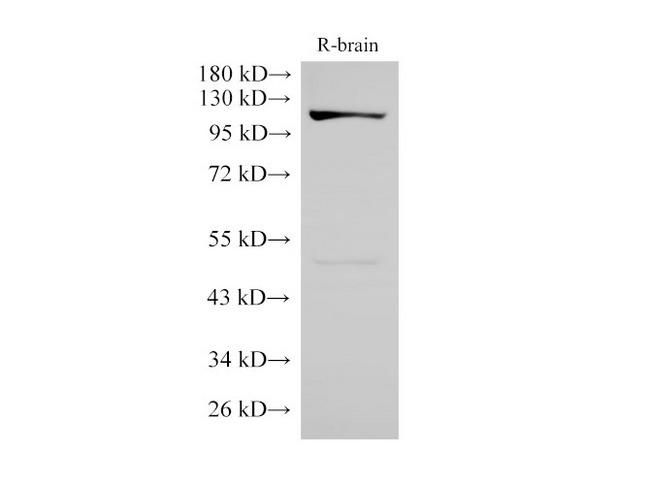 CD135 / FLT3 Antibody - Western Blot analysis of Rat brain using FLT3 Polyclonal Antibody at dilution of 1:3000